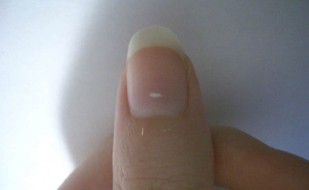 Prawda czy mit: Białe plamki na paznokciach