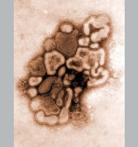 Pandemia ”świńskiej grypy” jest już faktem