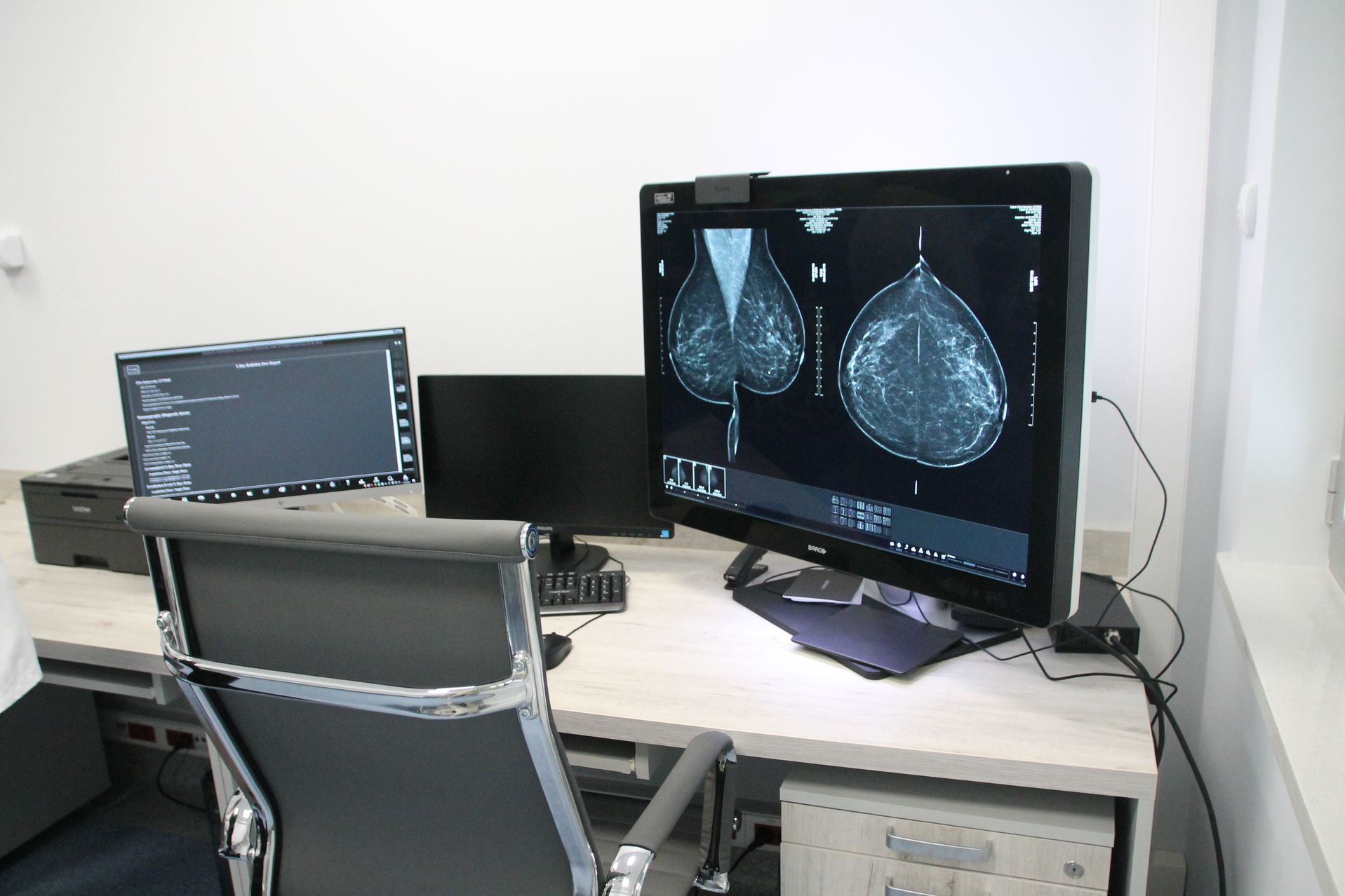 Poznań: Bezpłatna mammografia