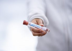 Kraków: W poniedziałki i wtorki najwięcej osób robi testy na koronawirusa