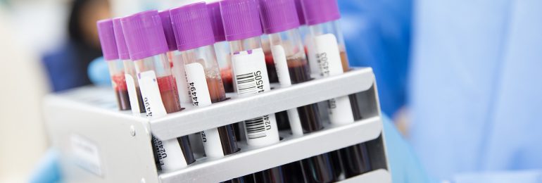 Proste badanie krwi otwiera ścieżkę diagnostyki specjalistycznej