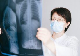 Nadciśnienie płucne wciąż zbyt późno diagnozowane